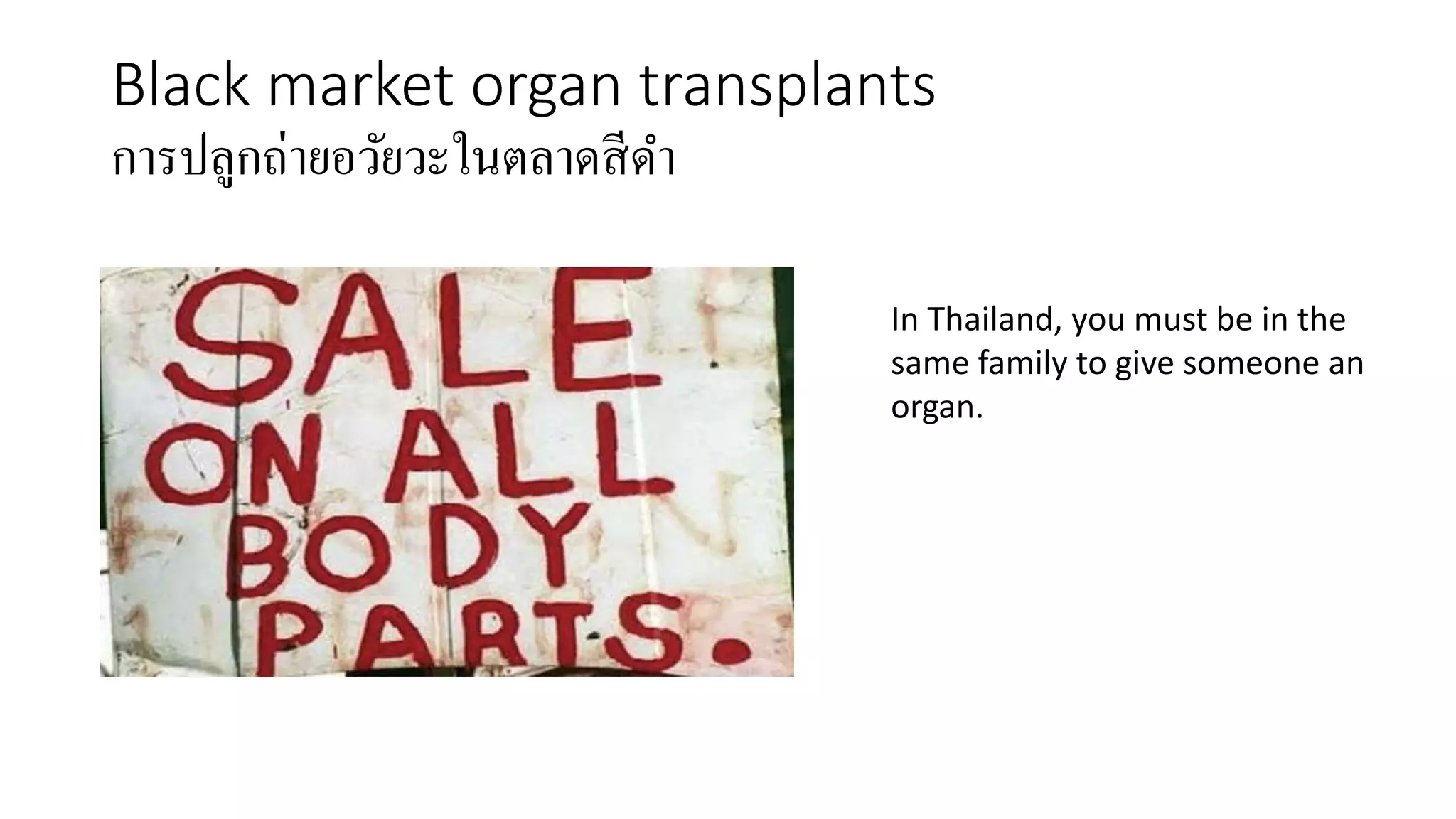 Black market organ transplants
การปลูกถ่ายอวัยวะในตลาดสีดา
In Thailand, you must be in the
same family to give someone an
organ.
 