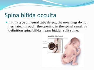 Spinal Defet Lifecycle, m 2 | PPTX