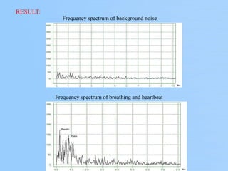 Frequency spectrum of background noise
Frequency spectrum of breathing and heartbeat
RESULT:
 