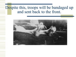 Despite this, troops will be bandaged up
and sent back to the front.
 