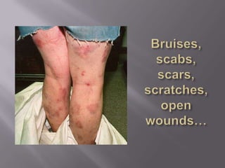 Bruises, scabs, scars,scratches, open wounds…