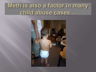 Meth is also a factor in many child abuse cases…