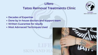 Decades of Expertise
Done by in-house doctors and support team
Written Guarantee for results
Most Advnaced Techniques Used
Lifero
Tatoo Removal Treatments Clinic
 