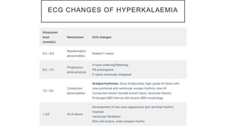 ECG CHANGES OF HYPERKALAEMIA
 