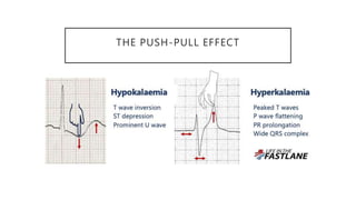 THE PUSH-PULL EFFECT
 