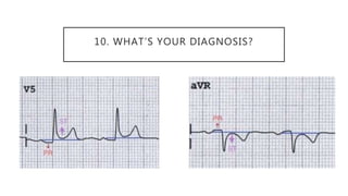 10. WHAT’S YOUR DIAGNOSIS?
 