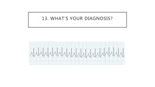 13. WHAT’S YOUR DIAGNOSIS?
 