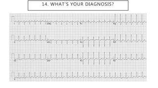14. WHAT’S YOUR DIAGNOSIS?
 