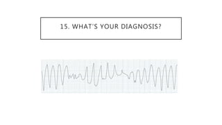 15. WHAT’S YOUR DIAGNOSIS?
 