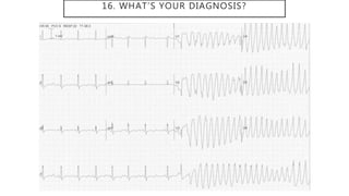 16. WHAT’S YOUR DIAGNOSIS?
 