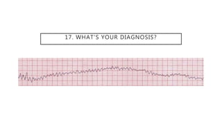 17. WHAT’S YOUR DIAGNOSIS?
 