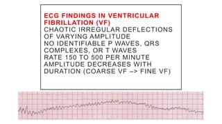 ECG FINDINGS IN VENTRICULAR
FIBRILLATION (VF)
CHAOTIC IRREGULAR DEFLECTIONS
OF VARYING AMPLITUDE
NO IDENTIFIABLE P WAVES, QRS
COMPLEXES, OR T WAVES
RATE 150 TO 500 PER MINUTE
AMPLITUDE DECREASES WITH
DURATION (COARSE VF –> FINE VF)
 