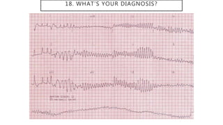 18. WHAT’S YOUR DIAGNOSIS?
 