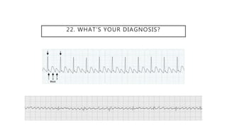 22. WHAT’S YOUR DIAGNOSIS?
 