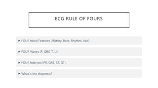 ECG RULE OF FOURS
 