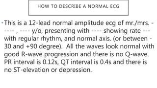 HOW TO DESCRIBE A NORMAL ECG
•This is a 12-lead normal amplitude ecg of mr./mrs. -
---- , ---- y/o, presenting with ---- showing rate ---
with regular rhythm, and normal axis. (or between -
30 and +90 degree). All the waves look normal with
good R-wave progression and there is no Q-wave.
PR interval is 0.12s, QT interval is 0.4s and there is
no ST-elevation or depression.
 