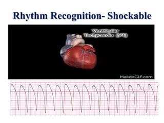 life saving skil.ppt during preganncy | PPTX