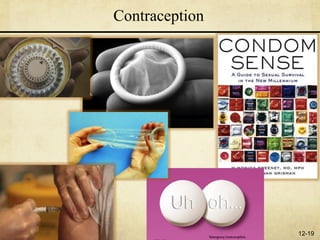 Contraception




                12-19
 