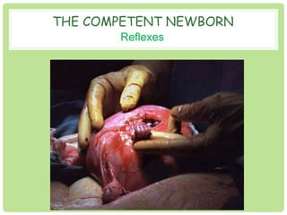 THE COMPETENT NEWBORN 
Reflexes 
[Surgery] 
 