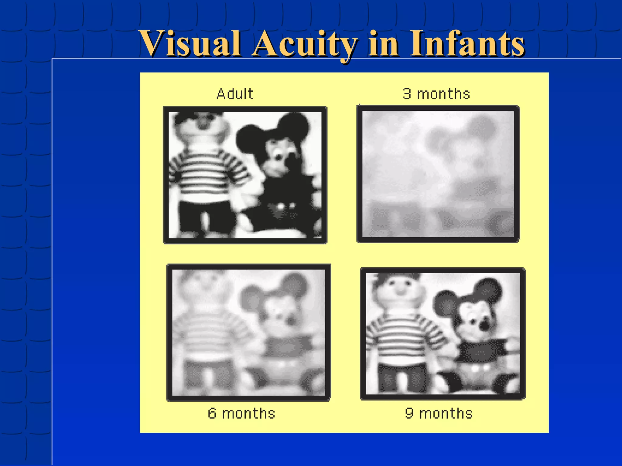 Visual Acuity in Infants

 