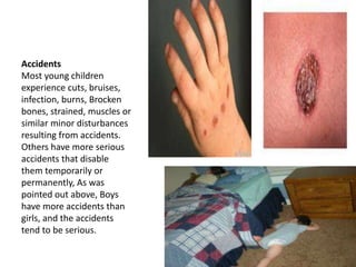 Accidents
Most young children
experience cuts, bruises,
infection, burns, Brocken
bones, strained, muscles or
similar minor disturbances
resulting from accidents.
Others have more serious
accidents that disable
them temporarily or
permanently, As was
pointed out above, Boys
have more accidents than
girls, and the accidents
tend to be serious.
 