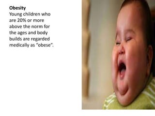 Obesity
Young children who
are 20% or more
above the norm for
the ages and body
builds are regarded
medically as “obese”.
 