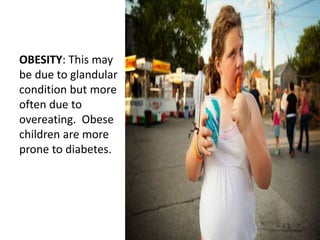 OBESITY: This may
be due to glandular
condition but more
often due to
overeating. Obese
children are more
prone to diabetes.
 