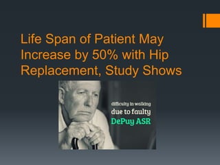 Life Span of Patient May
Increase by 50% with Hip
Replacement, Study Shows
 