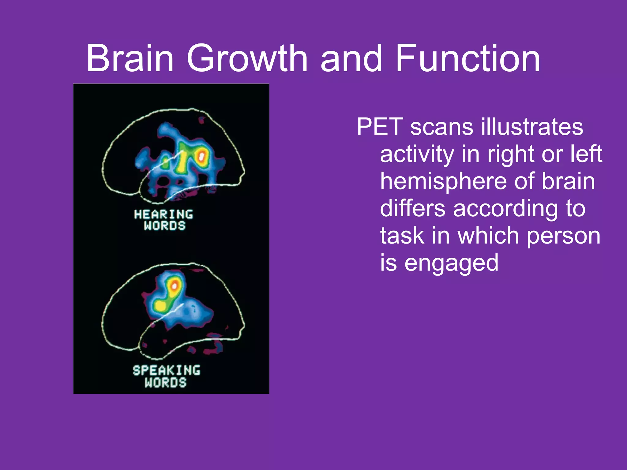 Brain Growth and Function PET scans illustrates activity in right or left hemisphere of brain differs according to task in which person is engaged 