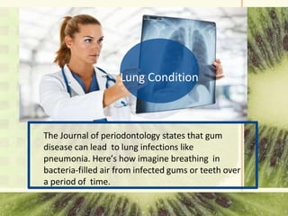 Lung Condition
The Journal of periodontology states that gum
disease can lead to lung infections like
pneumonia. Here’s how imagine breathing in
bacteria-filled air from infected gums or teeth over
a period of time.
 