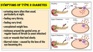 • urinating more often than usual,
particularly at night.
• feeling very thirsty.
• feeling very tired.
• unexplained weight loss.
• itchiness around the genital area, or
regular bouts of thrush (a yeast infection)
• cuts or wounds that heal slowly.
• blurred vision – caused by the lens of the
eye becoming dry.
Symptoms of type 2 diabetes
 