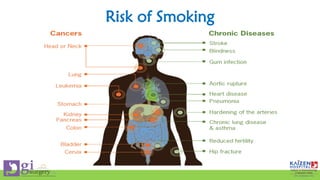 Risk of Smoking
 