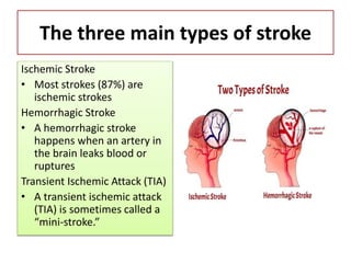 The three main types of stroke
Ischemic Stroke
• Most strokes (87%) are
ischemic strokes
Hemorrhagic Stroke
• A hemorrhagic stroke
happens when an artery in
the brain leaks blood or
ruptures
Transient Ischemic Attack (TIA)
• A transient ischemic attack
(TIA) is sometimes called a
“mini-stroke.”
 