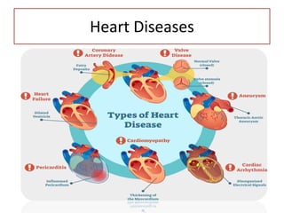 Heart Diseases
 