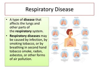 Respiratory Disease
• A type of disease that
affects the lungs and
other parts of
the respiratory system.
• Respiratory diseases may
be caused by infection, by
smoking tobacco, or by
breathing in second hand
tobacco smoke, radon,
asbestos, or other forms
of air pollution.
 