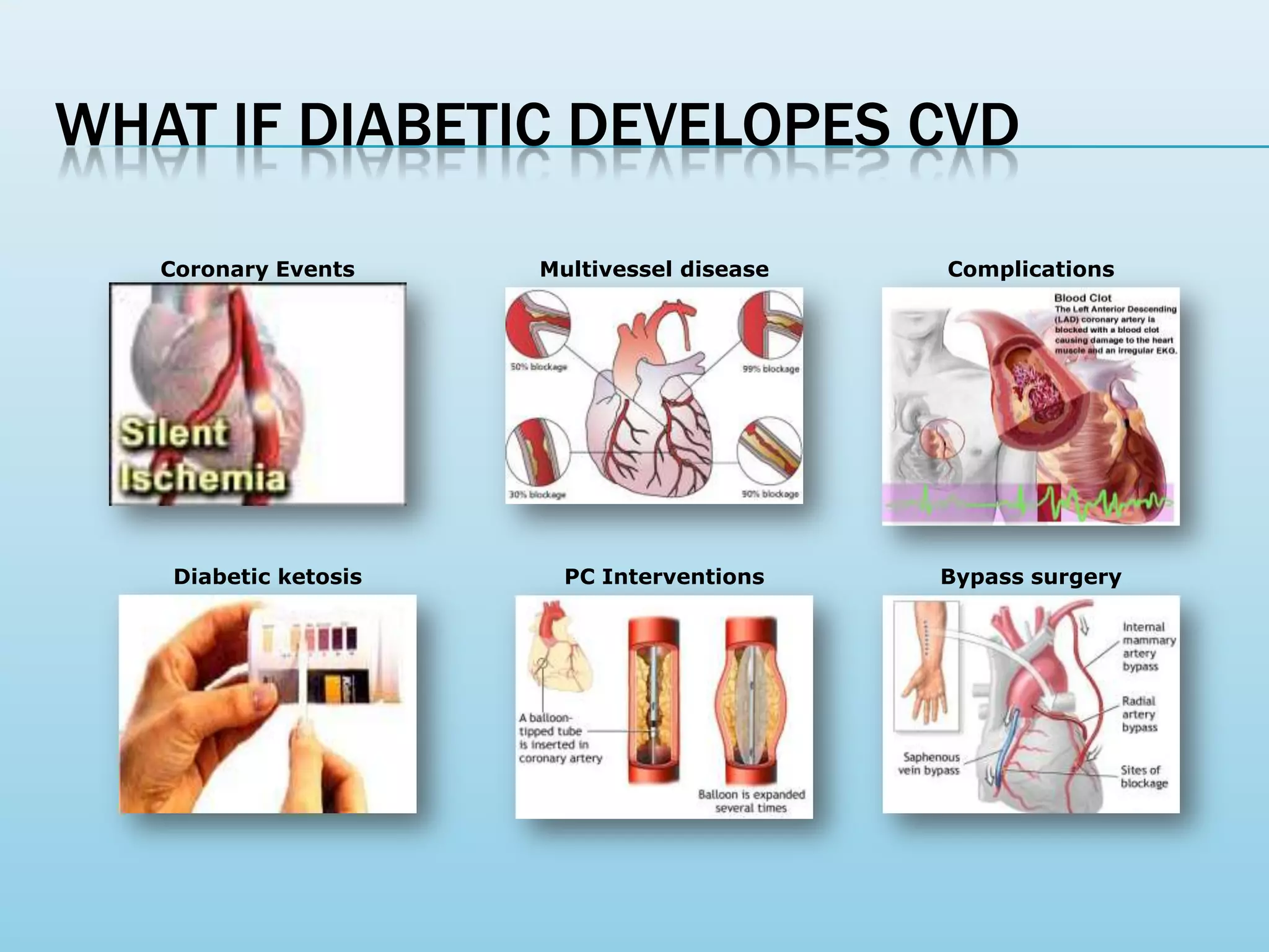 Life style modifications in Diabetes | PPTX