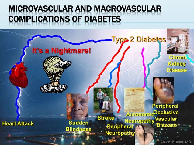 Life style modifications in Diabetes | PPTX