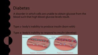 Diabetes
A disorder in which cells are unable to obtain glucose from the
blood such that high blood-glucose levels result.
Type 1- body’s inability to produce insulin (born with)
Type 2- body’s inability to respond to insulin (develop)
 