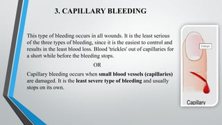 Comprehensive Guide to Life-Threatening Conditions: Bleeding, Drowning ...