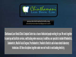 www.dentalimplantsindia.org
chinthamanidental@gmail.com
 