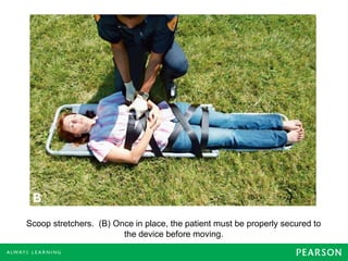 Scoop stretchers. (B) Once in place, the patient must be properly secured to
the device before moving.
 