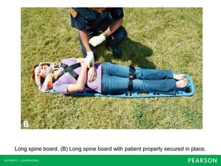 Long spine board. (B) Long spine board with patient properly secured in place.
 