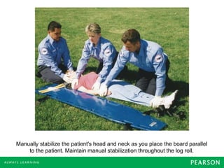 Manually stabilize the patient's head and neck as you place the board parallel
to the patient. Maintain manual stabilization throughout the log roll.
 
