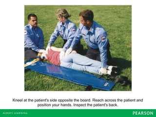 Kneel at the patient's side opposite the board. Reach across the patient and
position your hands. Inspect the patient's back.
 
