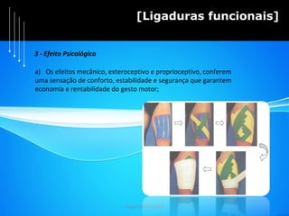 Hugo Pedrosa 2009 [Ligaduras funcionais] Os efeitos mecânico, exteroceptivo e proprioceptivo, conferem  uma sensação de conforto, estabilidade e segurança que garantem  economia e rentabilidade do gesto motor; 3 - Efeito Psicológico 