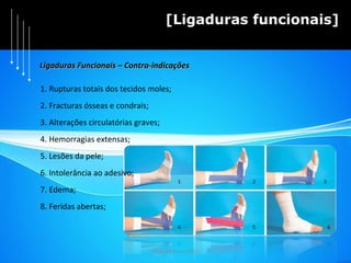 Hugo Pedrosa 2009 [Ligaduras funcionais] 1. Rupturas totais dos tecidos moles; 2. Fracturas ósseas e condrais; 3. Alterações circulatórias graves; 4. Hemorragias extensas; 5. Lesões da pele; 6. Intolerância ao adesivo; 7. Edema;  8. Feridas abertas; Ligaduras Funcionais – Contra-indicações 