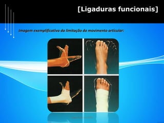 Hugo Pedrosa 2009 [Ligaduras funcionais] Imagem exemplificativa da limitação do movimento articular: 