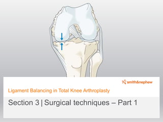 Ligament Balancing in Total Knee Arthroplasty
Section 3 | Surgical techniques – Part 1
 