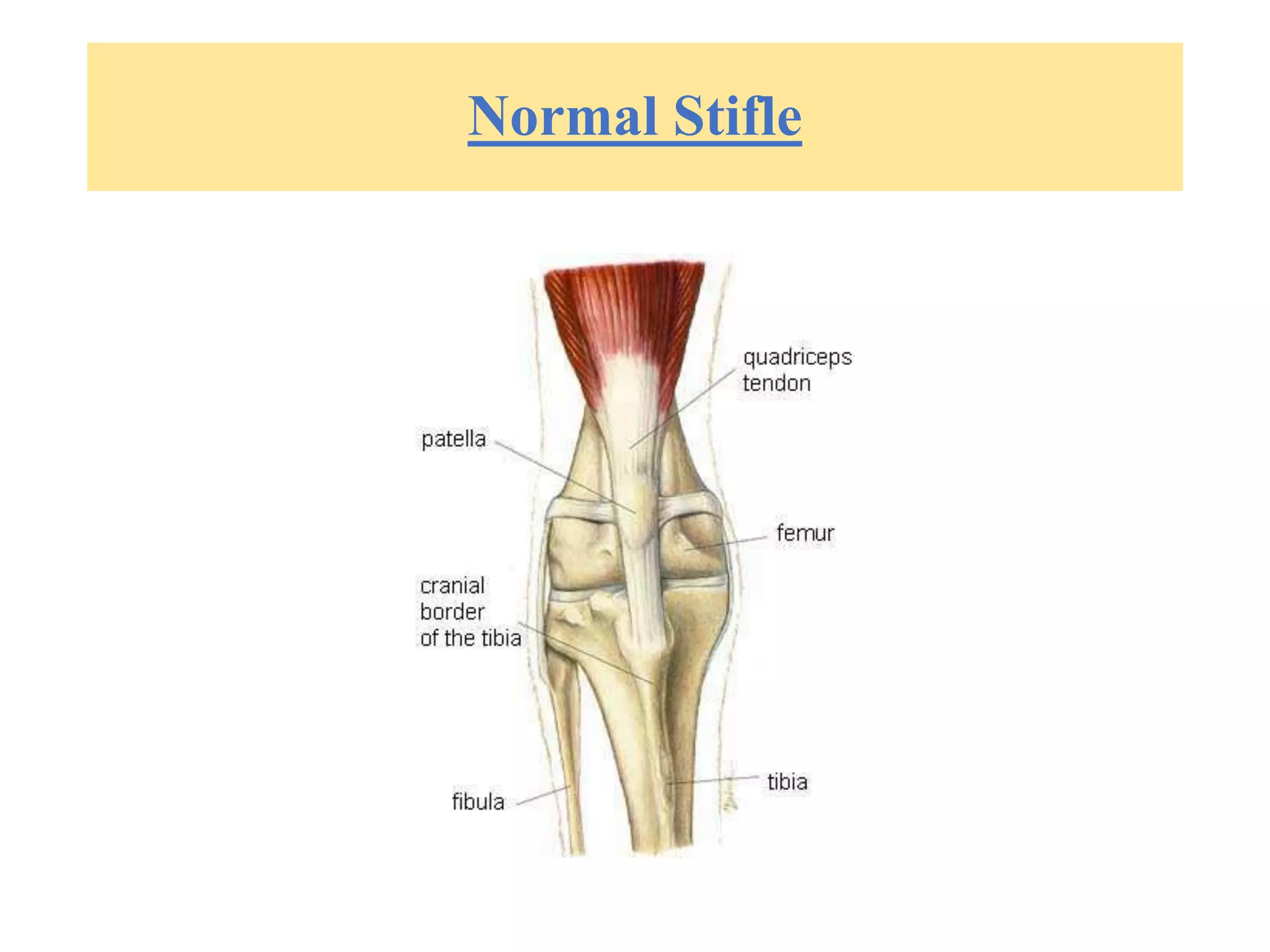 Ligament Injuries.pptx
