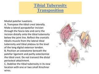 Tibial Tuberosity
Transposition
Medial patellar luxations.
A, Transpose the tibial crest laterally.
Make a lateral parapatellar incision
through the fascia lata and carry the
incision distally onto the tibial tuberosity
below the joint line. Reflect the cranialis
tibialis muscle from the lateral tibial
tuberosity and tibial plateau to the level
of the long digital extensor tendon.
B, Position an osteotome beneath the
patellar ligament and partly ostectomize
the tibial crest. Do not transect the distal
periosteal attachment.
C, Stabilize the tibial tuberosity in its new
location with one or two small Kirschner
wires.
 